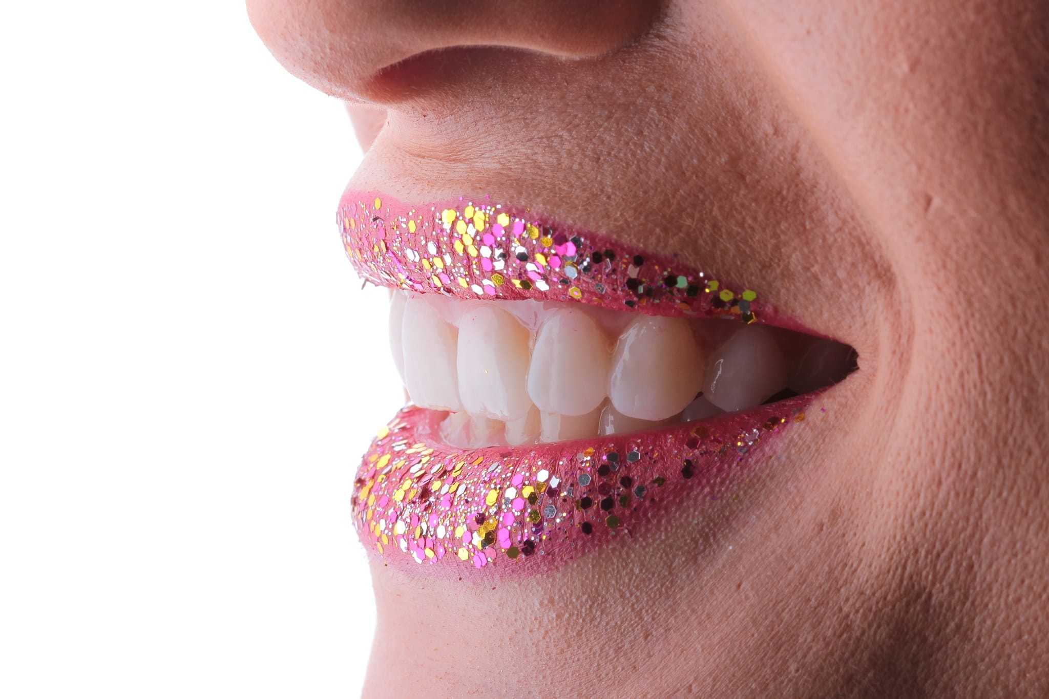 Fațetele dentare – Soluția ideală pentru un zâmbet spectaculos!