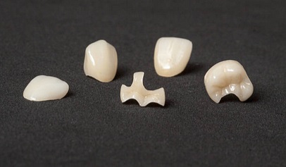 Ce ar trebui să știi despre coroanele dentare?